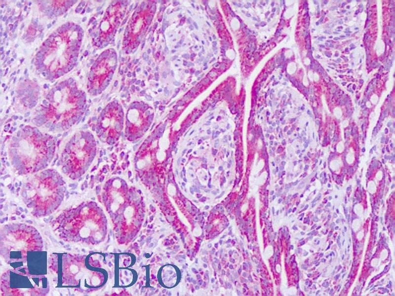 MRPL12 Antibody (aa87-136)