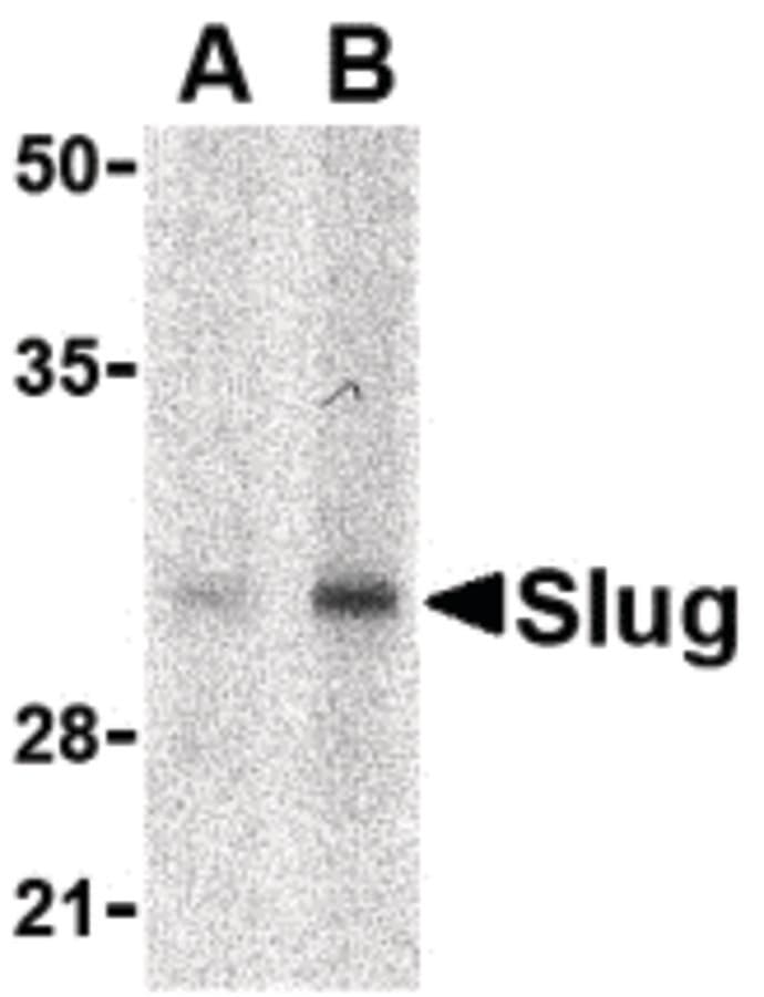 IHC-plus™ SNAI2 / SLUG Antibody