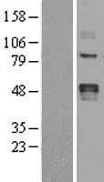 LOX / Lysyl Oxidase Protein (Over-Expression Lysate Myc-DDK (Flag))