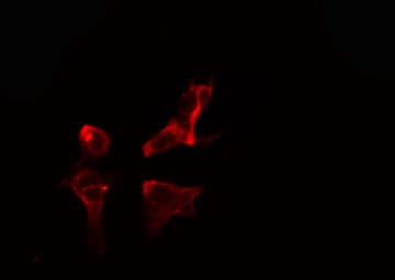 Polyclonal Rabbit anti-Human NMBR Antibody (IF, WB)