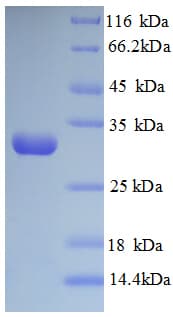 Human LOX / Lysyl Oxidase Protein (Recombinant 6His, N-terminus)