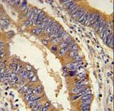 DHX58 / LGP2 Antibody (aa41-69)