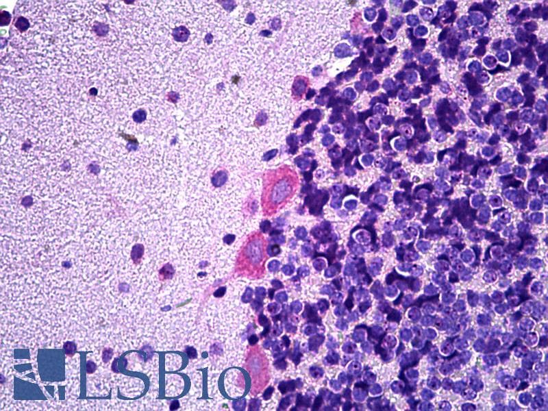 IHC-plus™ Polyclonal Rabbit anti-Rat ARHGEF9 / Collybistin Antibody (aa274-303, IHC, WB)