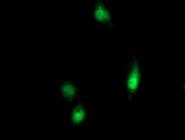 RGS16 Antibody (clone OTI3F3)