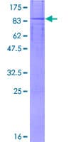 Human LPCAT4 Protein (Recombinant GST)