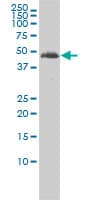 IHC-plus™ TUBA3C / Tubulin Alpha 3C Antibody (clone 3F10-2F2)