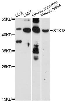 Polyclonal Rabbit anti-Human STX18 / Syntaxin 18 Antibody (WB)
