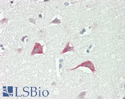 IHC-plus™ MYO7A / Myosin-VIIa Antibody (Internal)