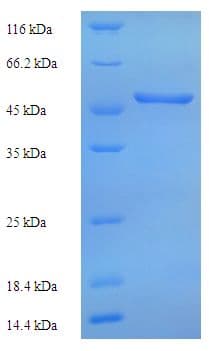 Human TDO2 Protein (Recombinant His)