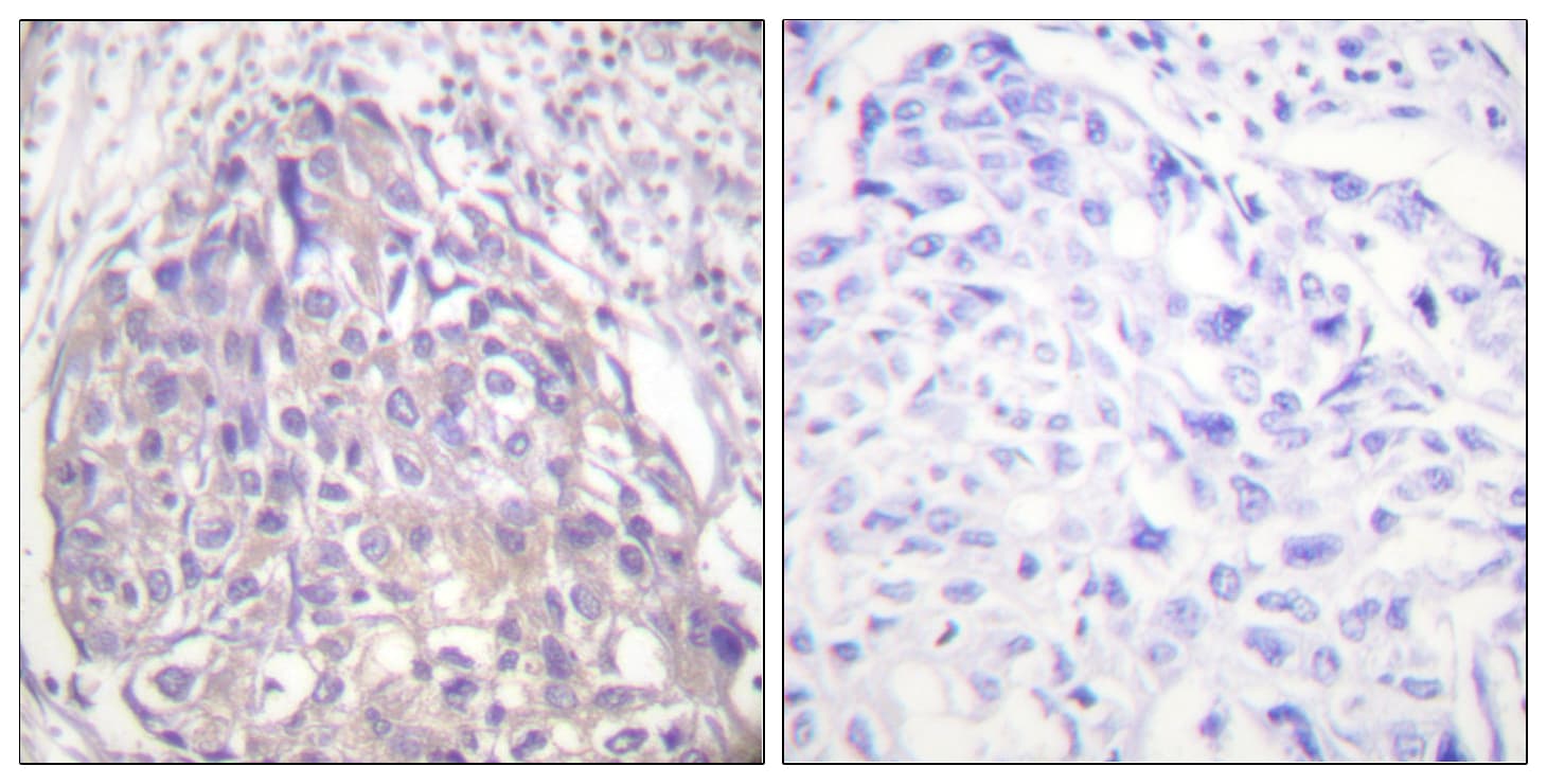 FOXO1+3+4 Antibody (phospho-Thr24/Thr32)