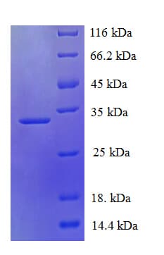 Human PDZD11 / PISP Protein (Recombinant His-SUMO)