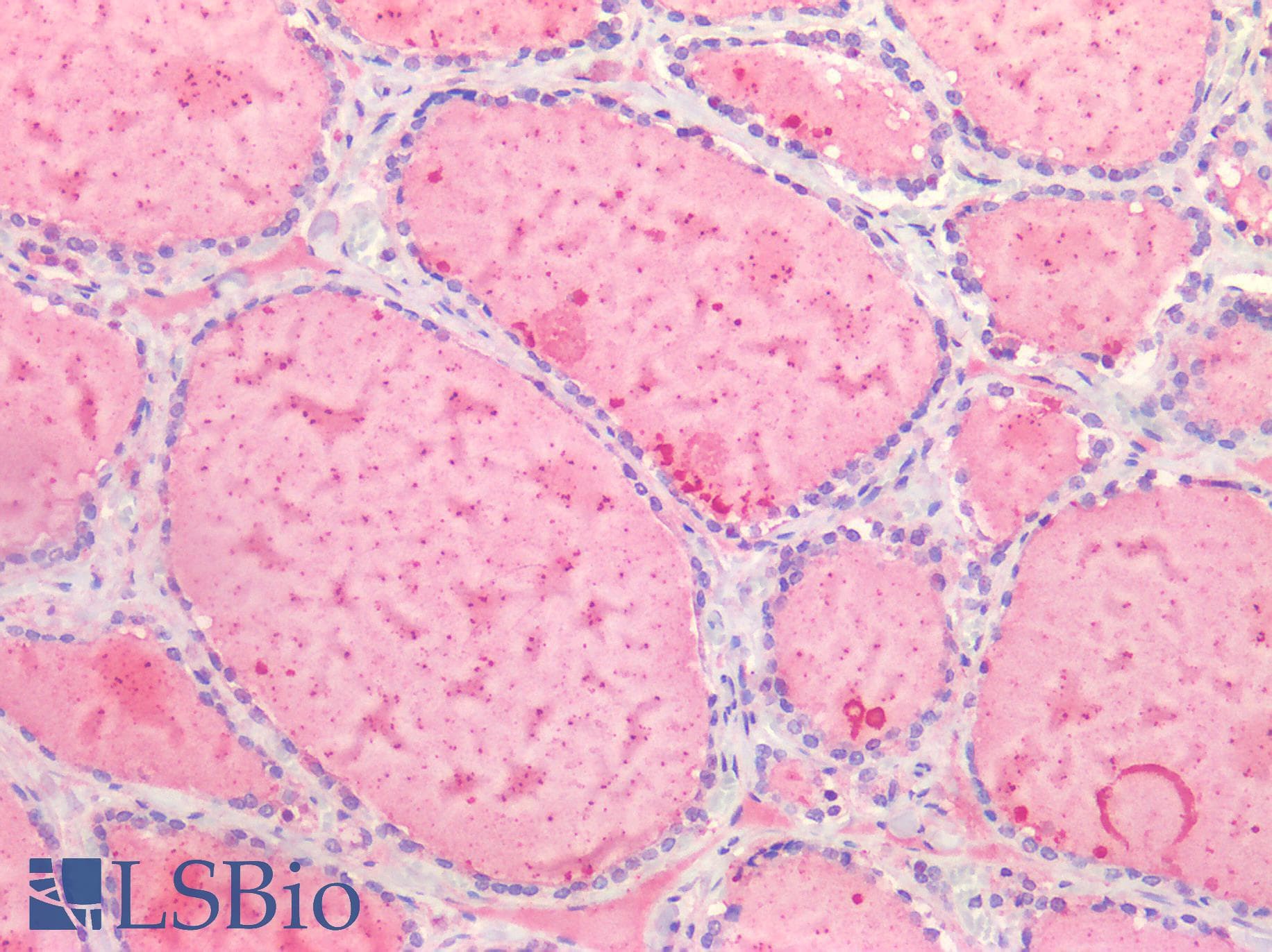 IHC-plus™ ALK2 / ACVR1 Antibody