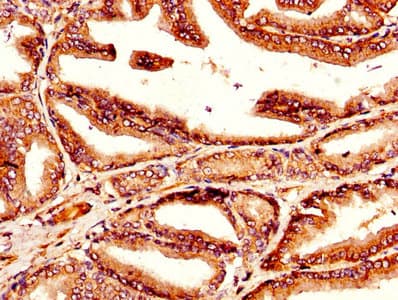 Polyclonal Rabbit anti-Human TGM4 / Transglutaminase 4 Antibody (aa1-684, IHC, IF)