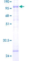 Human FARSB Protein (Recombinant GST)