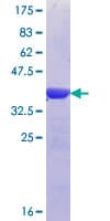 Human U2AF2 / U2AF65 Protein (Recombinant GST, N-terminus)