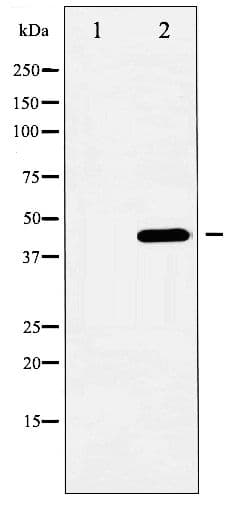 Polyclonal Rabbit anti-Human SMAD3 Antibody (phospho-Ser204, WB)