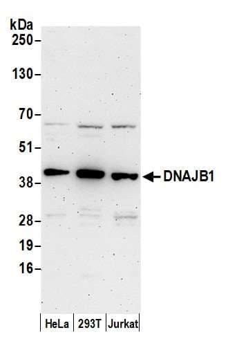 DNAJB1 / Hsp40 Antibody (aa290-340)