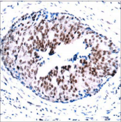 STAT5A Antibody