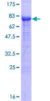 Human EED Protein (Recombinant GST)