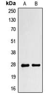 PRX-1 / PRRX1 Antibody (Internal)