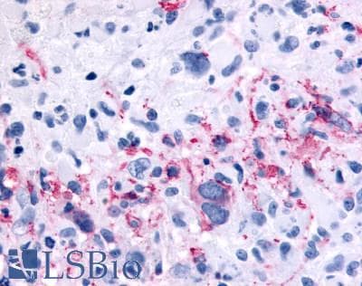 PathPlus™ GRM6 / MGLUR6 Antibody (N-Terminus)