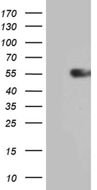 Monoclonal Mouse anti-Human IL15RA Antibody (clone OTI7F4, aa31-267, WB)