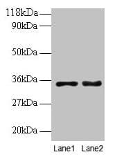 PTDSS1 Antibody