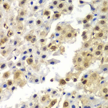 SYNCRIP / HnRNP Q Antibody