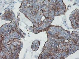 ZNF365 Antibody (clone OTI4F8)