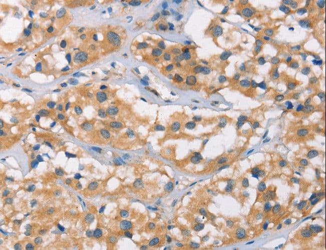 DSC2 / Desmocollin 2 Antibody