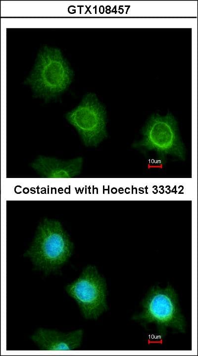Polyclonal Rabbit anti-Human PF4V1 Antibody (aa40-104, IHC, WB)