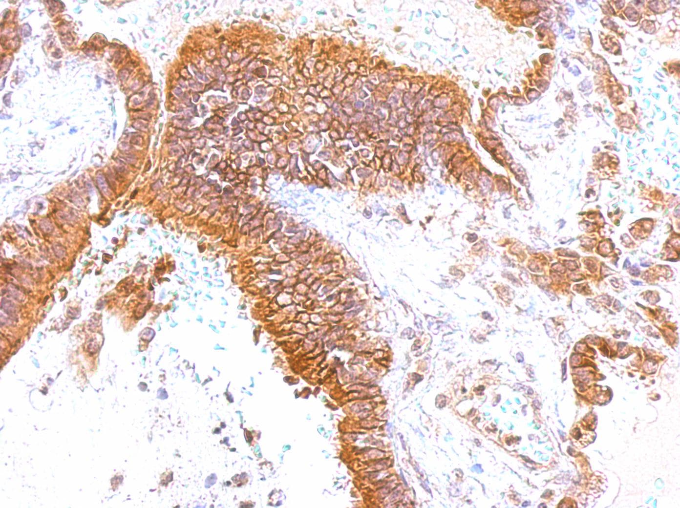 GEM / KIR Antibody (aa1-44)