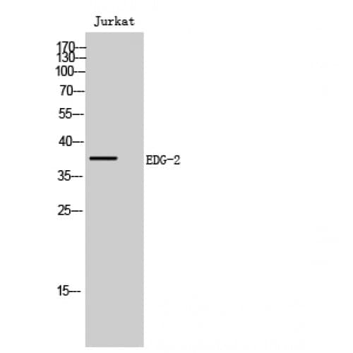LPAR1 / LPA1 / EDG2 Antibody (20-100 aa, N-terminal)