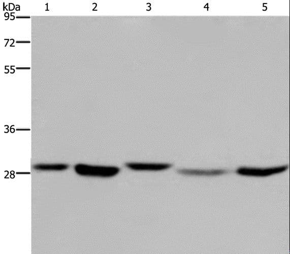 SCEH / ECHS1 Antibody