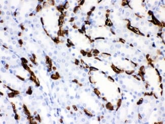Polyclonal Rabbit anti-Human SLC4A1 / Band 3 / AE1 Antibody (aa28-365, IHC, WB)