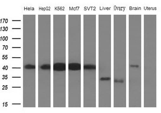 Monoclonal Mouse anti-Human HnRNP-E1 / PCBP1 Antibody (clone OTI3D12, aa1-225, IHC, WB)