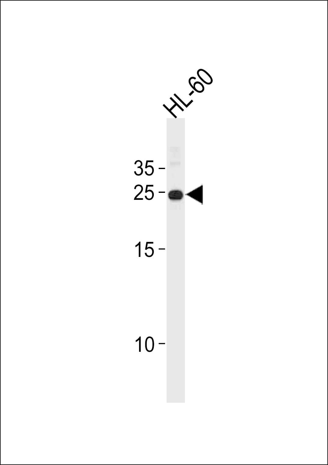 Polyclonal Rabbit anti-Human HOXA6 Antibody (aa105-133, WB)