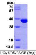 Human SULT1E1 / Sulfotransferase 1E1 Protein (Recombinant His)