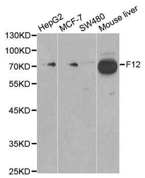 Polyclonal Rabbit anti-Human F12 / Factor XII Antibody (WB)