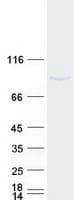 Human KIAA1530 Protein (Recombinant Myc-DDK (Flag))