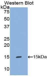 IL8 / Interleukin 8 Antibody (aa23-101)