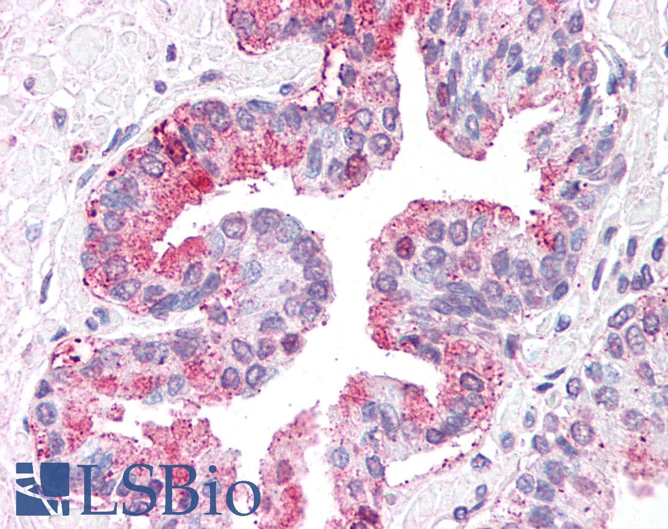 IHC-plus™ ARTS1 / ERAP1 Antibody (Internal)