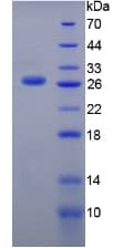 Mouse TG / Thyroglobulin Protein (Recombinant 6His, N-terminus)