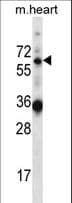 Polyclonal Rabbit anti-Human GATAD2B Antibody (aa1-30, WB)