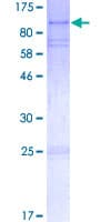 Human Eosinophil Peroxidase / EPX Protein (Recombinant GST)