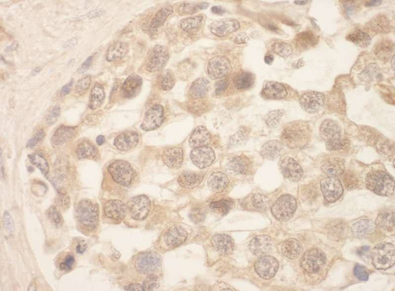 SRPK1 Antibody (aa275-325)