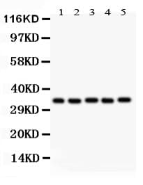 HOXA11 Antibody (aa74-245)