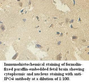 Polyclonal Rabbit anti-Human IPO4 Antibody (aa136-289, IHC, WB)