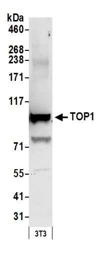IHC-plus™ TOP1 / Topoisomerase I Antibody (aa715-765)