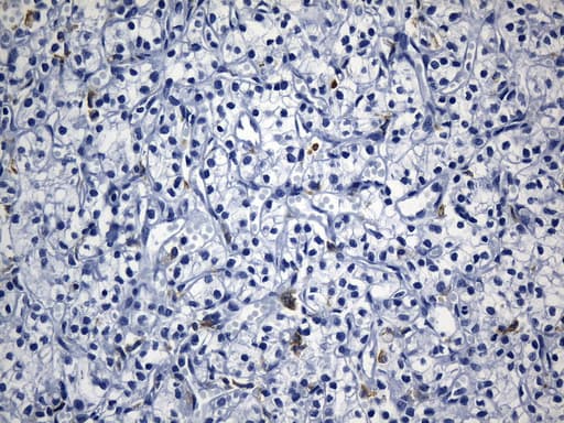Monoclonal Mouse anti-Human MSR1 / CD204 Antibody (clone UMAB247, aa197-451, IHC)